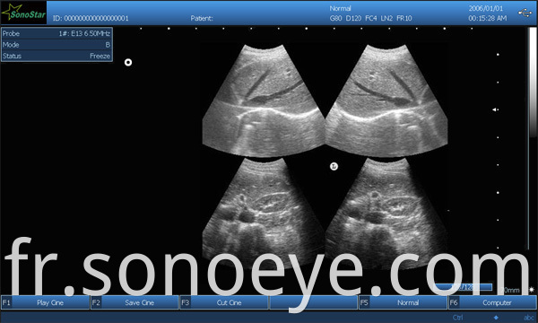 image for labtop ultrasound